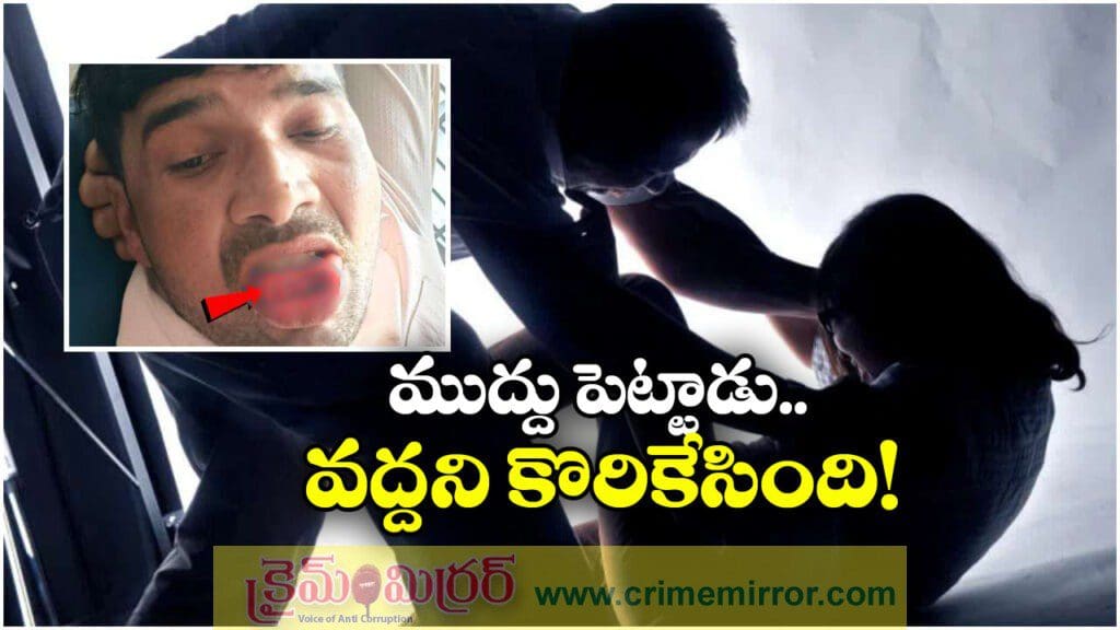 Viral News: వద్దన్నా ముద్దు పెట్టిన ప్రియుడు, నాలుక కొరికేసిన ఎక్స్ గర్ల్ ఫ్రెండ్!