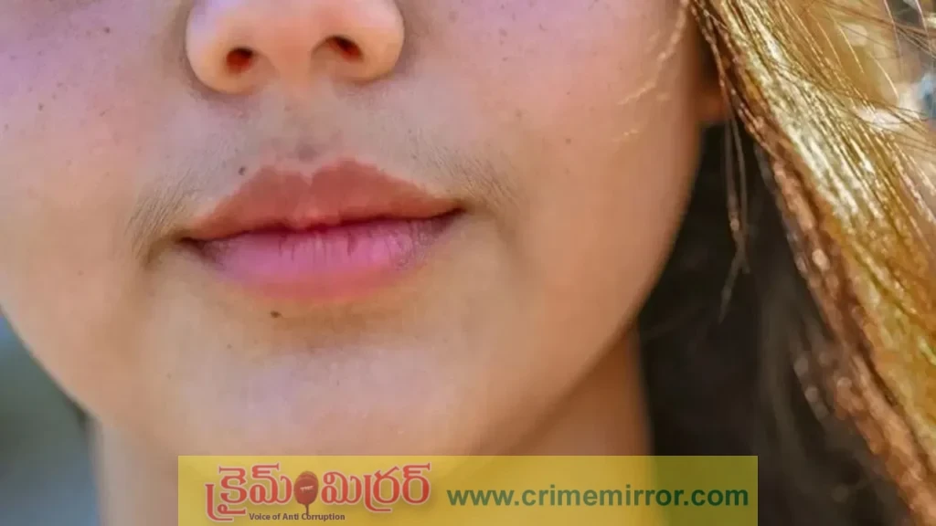 Teenage Changes: టీనేజ్ అమ్మాయిలకు మీసాలు ఎందుకు వస్తాయో తెలుసా?