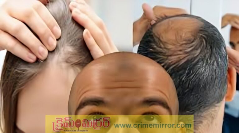 బట్టతల ఉన్నవారికి గుడ్ న్యూస్.. మగాళ్లూ.. ఇక తలెత్తుకోండి!