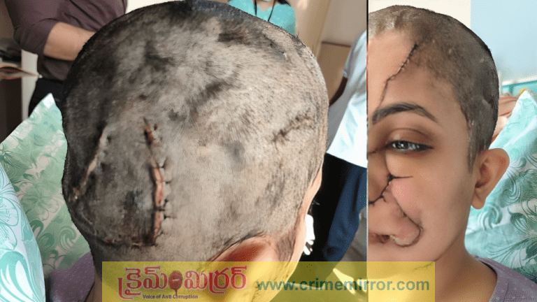 Shocking video: పెంపుడు కుక్క దాడి చేయడంతో మహిళకు 50 కుట్లు