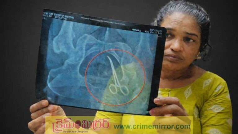 kerala medical negligence surgical scissors left inside woman abdomen five years after surgery