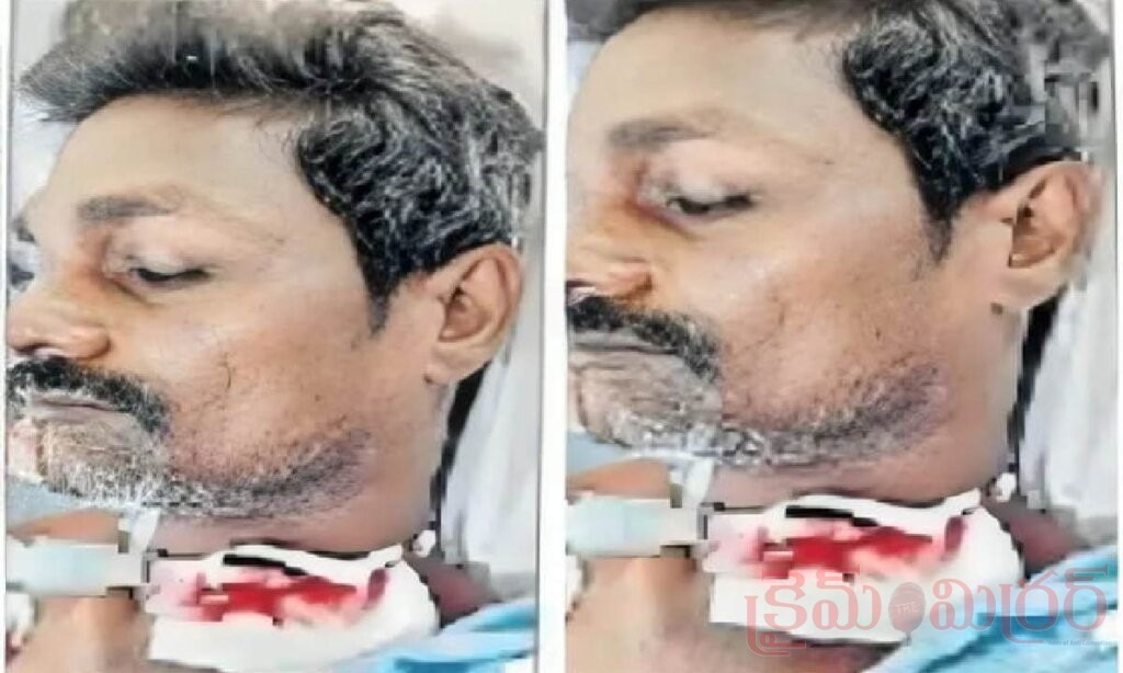బ్లేడ్ తో భర్త గొంతు కోసి దాడి చేసిన భార్య..