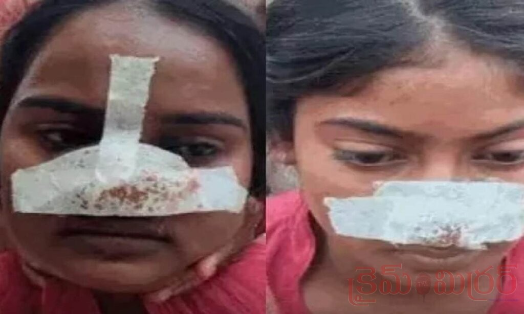 భార్య ముక్కు కోసేసిన భర్త… ప్రతీకారంతో భర్త సోదరిని ఏం చేశారంటే!