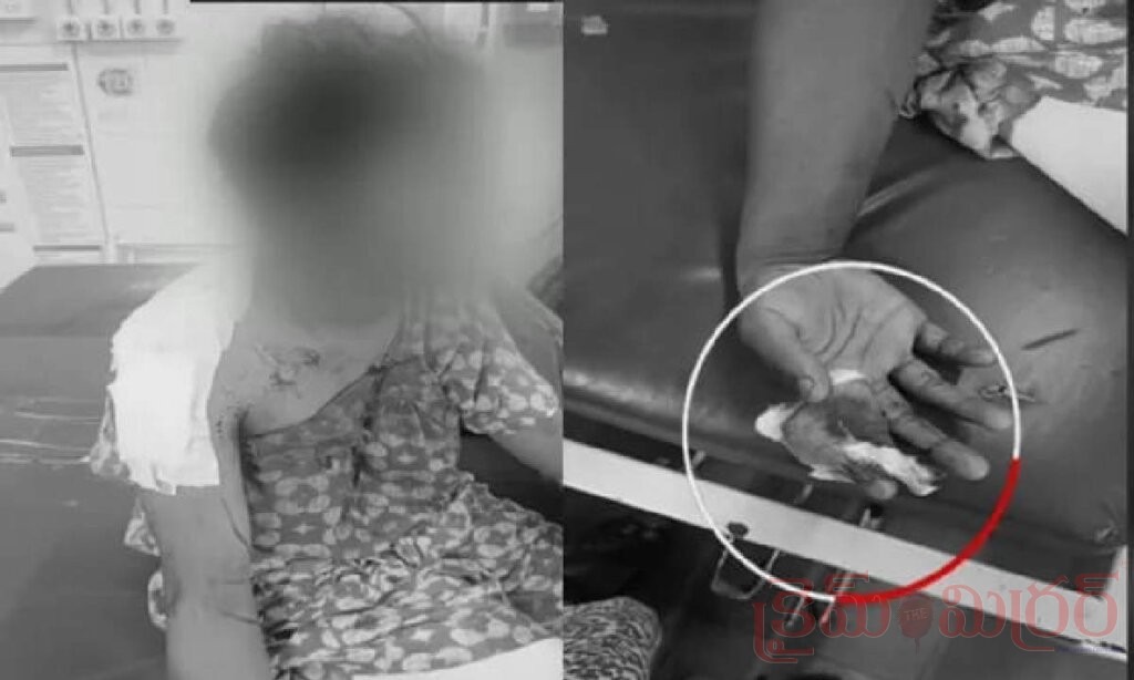 తిరుపతిలో మైనర్ బాలికపై బ్లేడ్ దాడి.. గతంలో యాసిడ్ దాడి కలకలం