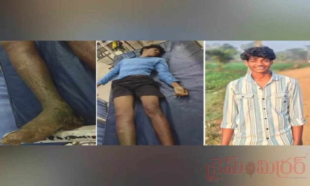పాము కాటుతో యువకుడి మృతి.. నాటు వైద్యం వికటించడంతో తీవ్ర విషాదం