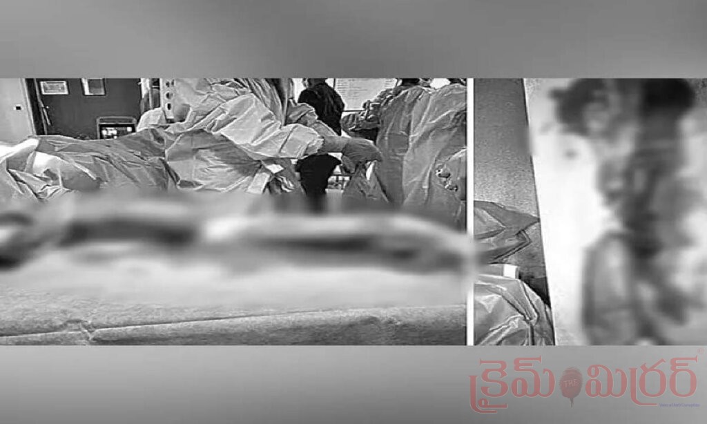 డ్రిల్లింగ్ మెషీన్‌తో పని చేస్తుండగా ఘోర ప్రమాదం.. 10 గంటల శస్త్రచికిత్సతో యువకుడి చేతికి పునర్జీవం